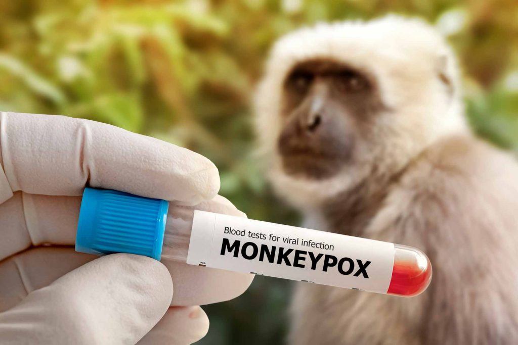 Prueba PCR de la viruela del mono en Colombia - Foto de referencia