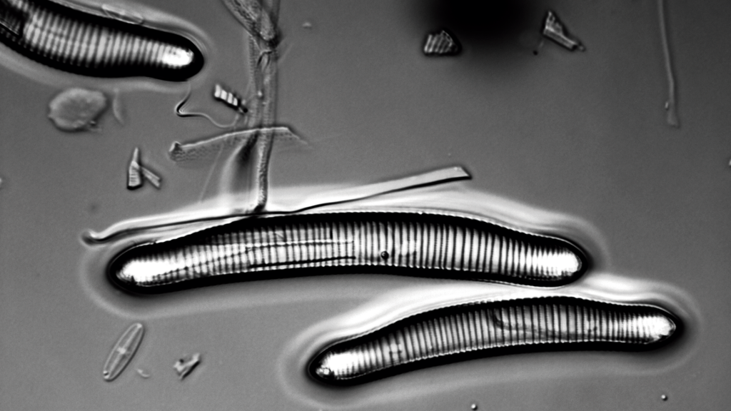 Las diatomeas, unas pequeñas algas que se encuentran en el fondo de las lagunas de páramo, dan pistas sobre las condiciones de su entorno.