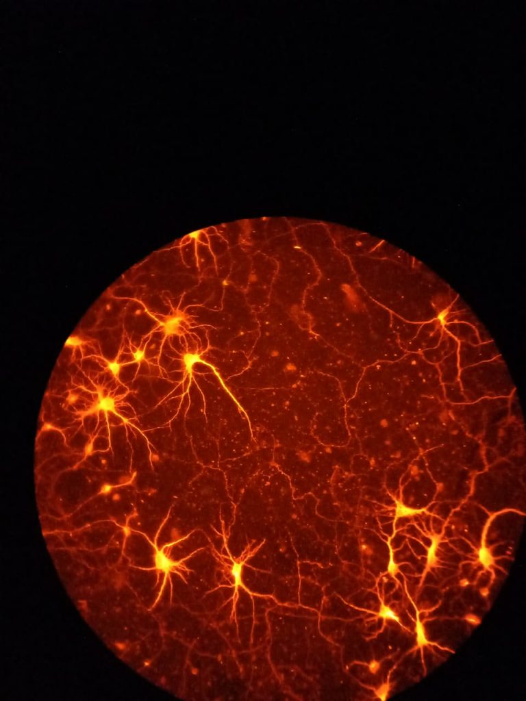 Neuronas bajo el microscopio teñidas con un tinte fluorescente. Foto: Archivo particular