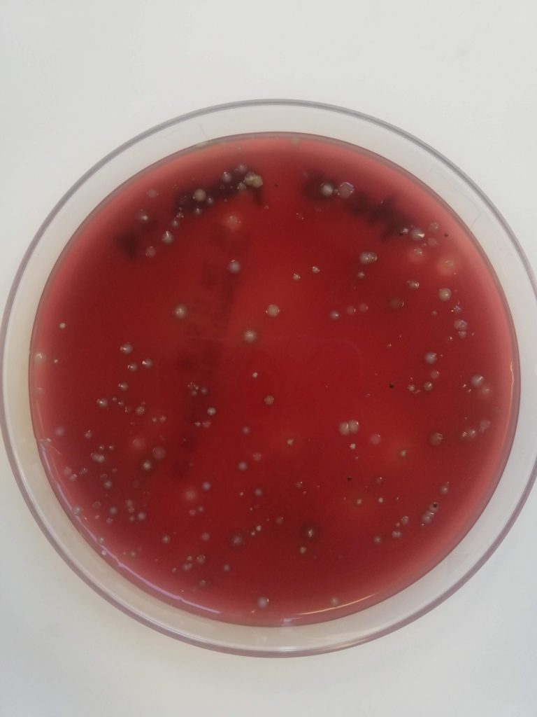 Microorganismos provenientes de la boca de un paciente cultivados en agar sangre, una mezcla de gelatina de agar con sangre de oveja. Foto: archivo particular de la investigadora.