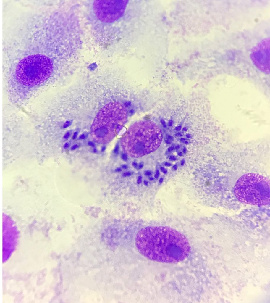 Así se ve un cultivo de células infectas con  con amastigotes de T. cruzi. Foto cortesía de Daniel Pardo. 