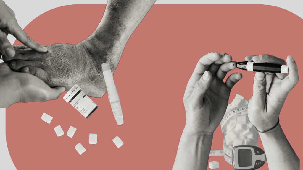 Patente nacional respalda tecnología javeriana para el cuidado del pie diabético 