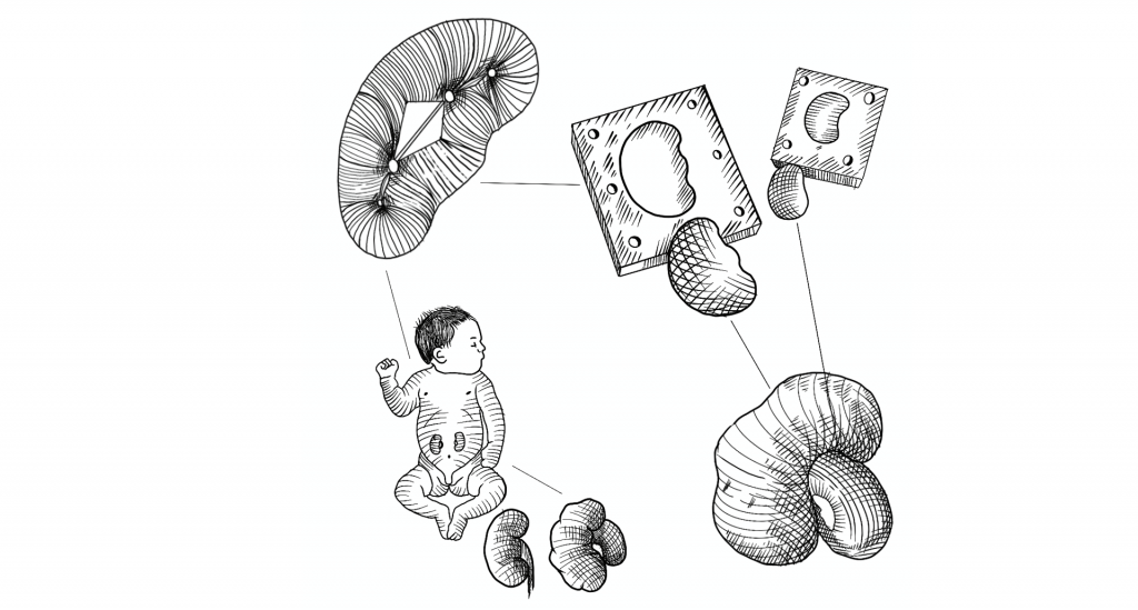 Los investigadores de Morphitec diseñaron un modelo anatómico para la cirugía laparoscópica pediátrica y un modelo de sutura quirúrgica. / Ilustración: Lina Espitia