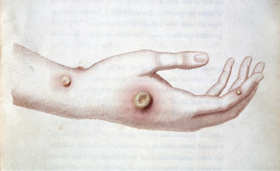 Vacunas: dos siglos de ciencia y voluntad colectiva a propósito de la Semana de la Vacunación